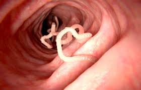 tapeworm